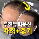 돈값하는집 | 부천두피문신 가격, 좀 비싸지만 돈값하는 대만족 후기