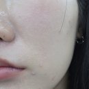라이온미 수원점 | 인계동 피부관리 라이온미 수원점 내돈내산 찐 후기!