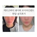 더브이라인 | [내돈내산] 에르고바디 쉐이피 브이라인밴드/한달후기/ems밴드/후기기록