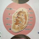 아이디메디칼 | 의료인이 관리하는 홍대 피어싱 &#39;아이디메디컬&#39; 귓바퀴 피어싱 후기