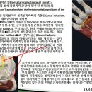 [11강-발목/발-15](94강) 무지외반등 발허리발가락관절의 변형, 발가락뼈사이관절, 권양기효과 이미지