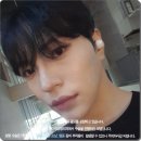 본빌딩 앞 | 남자 쌍수 앞트임 효과 있을까? 비용, 회복기간까지 후기에서 본 핵심 분석