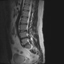 엠알아이 이미지