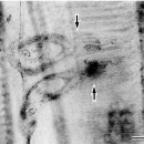 붉바리 아가미 기생 단생 흡충류 Pseudorhabdosynochus epinepheli 이미지