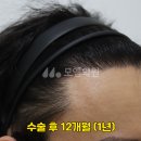 모엠의원 이미지