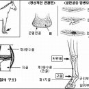 제1지골 근위단 골연골증 이미지