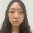 천안 피부관리 스토리에스테틱 작은 얼굴 관리 찐 후기