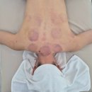 삼정한의원 | 부산 서면 목어깨관리 잘하는곳 더유 에스테틱 찐솔직후기