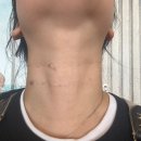 안양톤즈의원 네이버블로그