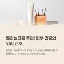 희망약국 | 멜라논크림 처방 가격 부작용 사용법 후기 기미 케어의 새로운 희망