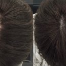 촘촘 스칼프 이미지