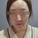 더예쁨스킨케어