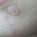 봄메디케어 이미지