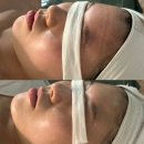 오운스킨라운지 | 언주역 오운스킨라운지 예신관리 예쁜 머메이드 라인 찾기