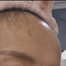 참바른약국 | 피부가려움증 달래주는 EGF 재생크림, 무너진 피부장벽 채워주는 약국화장품 지피덤 후기