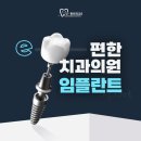 안산치과후기 임플란트 기준으로 세워야하는 부분?