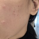 해피부과의원 | [잠원 피부과 추천] 해피부과 의원