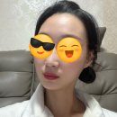 솔한 | 없어지면 안되서 쓰는 서창동 피부과 #솔한 탄력관리 솔직후기 MTS & PDRN 연어앰플