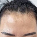 쎄뚜헤어라인