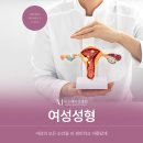 미소래 여성병원 네이버블로그