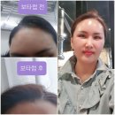 김성희뷰티케어 | [보타랩]한달사용 솔직후기