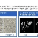 [허리디스크]허리디스크 치료방법 이미지