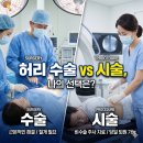 창조자연치유 | 허리 디스크, 수술 없이 '자연 치유' 가능할까? (MRI로 직접 확인한 후기)