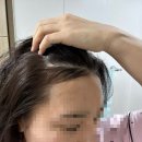 먼 | 청담 드레스먼 잔머리펌 후기