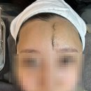 헤어하리(Hair.Ha-ri) | [김포] 피부국가자격증 교육 가능한 뷰티하리 / 스캔플래닝 피부관리 후기