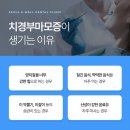방배동에 있는 치과 추천 치경부마모증 치료