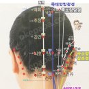 뇌호 (腦戶)-GV17 이미지