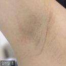 새원약국 | 팔꿈치 목 겨드랑이 색소침착 사타구니까지 퓨어턴28 착색크림 솔직 리뷰