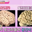 싱긋보청기