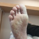 세상편한발톱