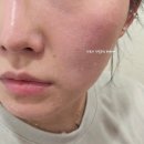 웰뷰파크 | 수원피부샵 : 인계동 웰뷰티힐러 스킨&amp;바디 복부관리 후기