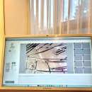 클래시 | 강남 압구정 두피탈모관리 전문 WT메소드 클래시 후기