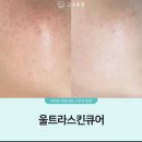 고운피부에스테틱 이미지