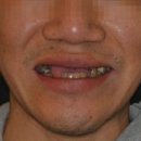 미라클원 이미지