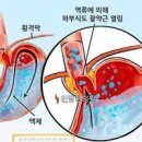 공복 속쓰림 아침 식후 심한 이유 이미지