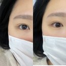 브로우 초이