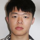 안면유통 | 안면비대칭 시술, 재발하지 않은 2가지 이유