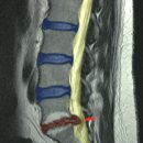 국군수도한의원 | 허리 통증으로 고통받는 분들께 꿀팁 [20년간 허리 통증 치료 경험/광고 아님]