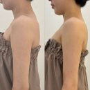 아늘 | 하남피부관리 아늘담에스테틱ㅣRSPT 신부관리로 드레스 라인 고민 해결