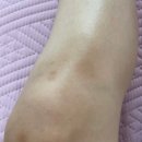 페이크러버스 | [일상]_ 몸살+그날🩸+시험📑 | 그날 입터짐 방지 | 하루 -2kg🤒 | 졸업발표, 시험, 팀플, 공모전, 운동...