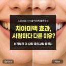 서울두정치과) 치아미백 효과 사람마다 다른 이유! 원리부터 주의사항 총정리