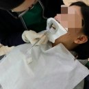 동래치아교정 동래구치아미백 미주치과병원 이용후기에요