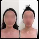 온앤유에스테틱 | wedding(4) 대구 에스테틱 18번 방문한 내돈내산 후기 :: 온앤유에스테틱