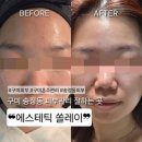 송정동-3 | 구미 피부관리 혼주관리까지 가능한 송정동 피부샵, 에스테틱 쏠레이 방문기💆‍♀️