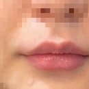 르에이치의원 이미지