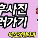 예진성형 네이버블로그